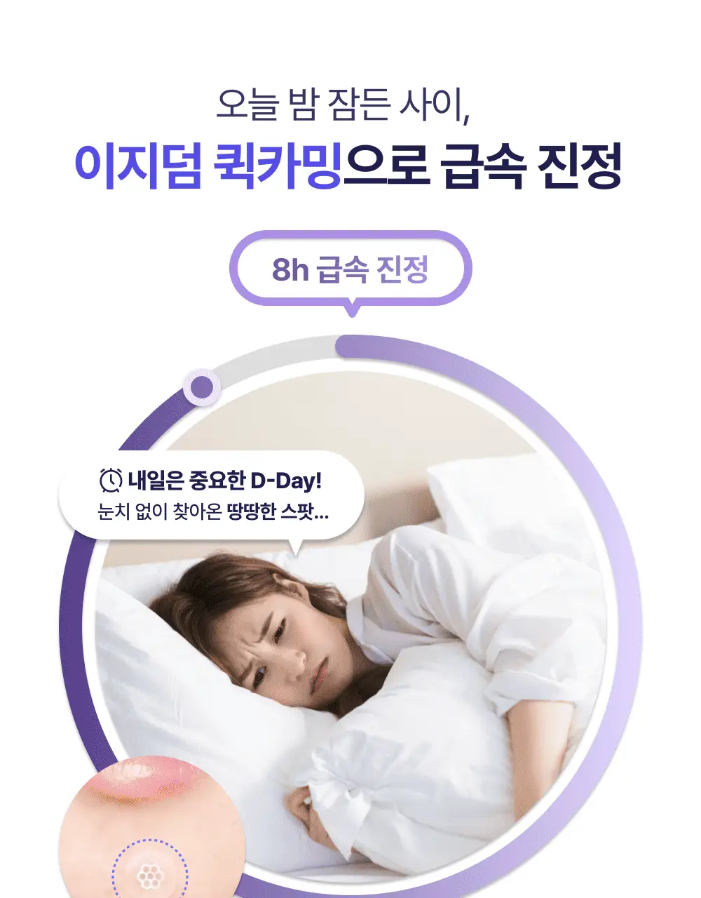[앰플 단독증정/1등 응급패치] 이지덤 퀵카밍 스팟패치 8매 기획 (+진정앰플) / 트러블패치 상세페이지 13